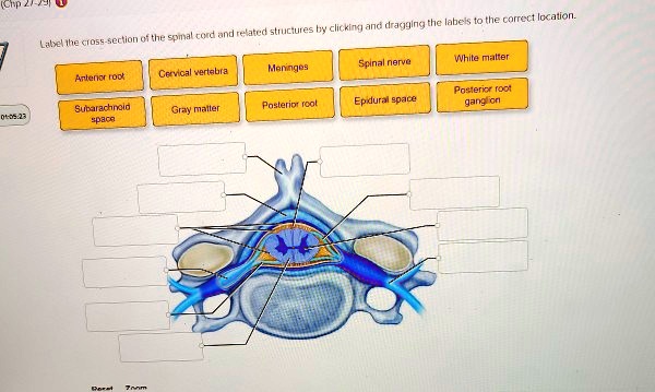 Solved Chapter Label The Cross Section Of The Spinal Cord And