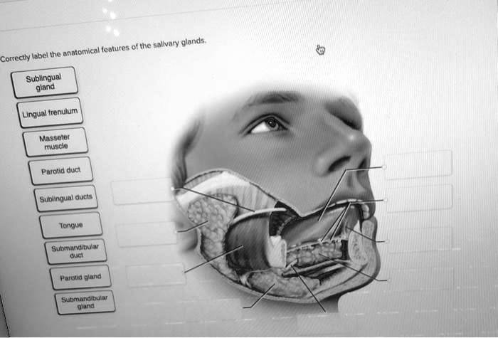 Solved Correctly Label The Anatomical Features Of The Salivary Glands