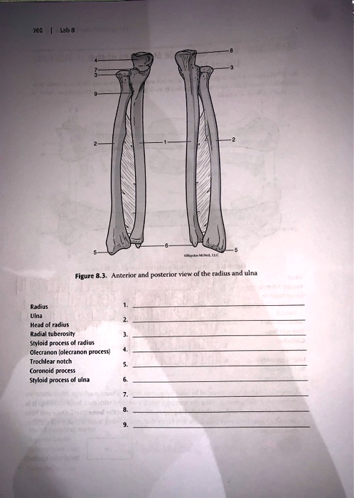 Solved Figure Anterior And Posterior View Of The Radius And Ulna