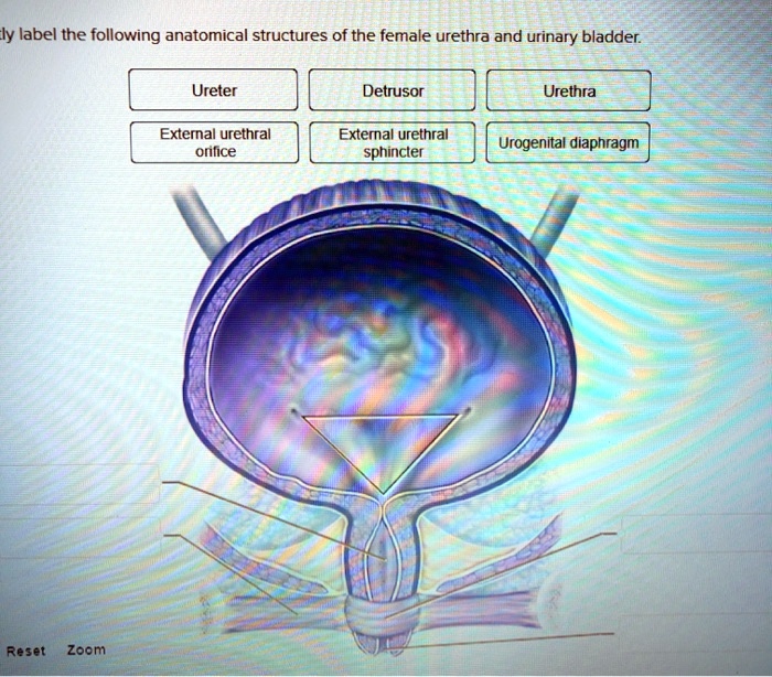 Solved Please Carefully Label The Following Anatomical Structures Of