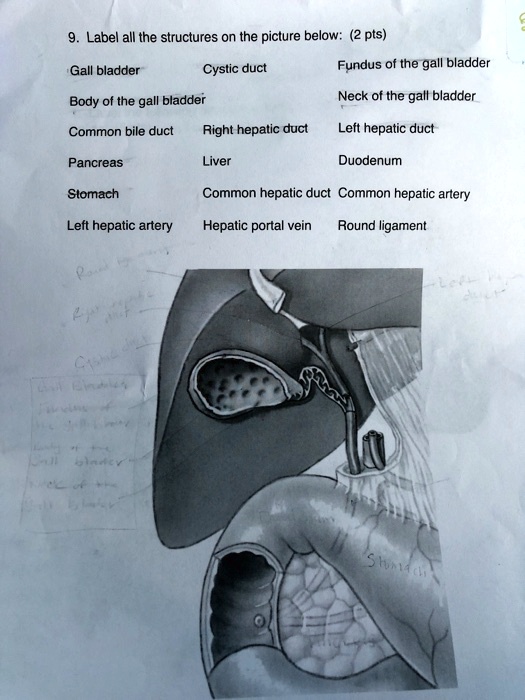 SOLVED Label All The Structures On The Picture Below Pts Gall