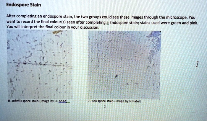 Solved Endospore Stain After Completing An Endospore Stain The Two