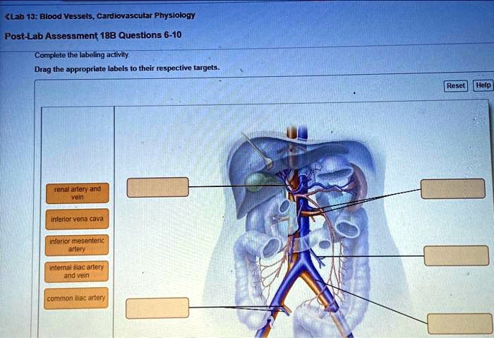 SOLVED Lab 13 Blood Vessels Cardiovascular Physiology Post Lab