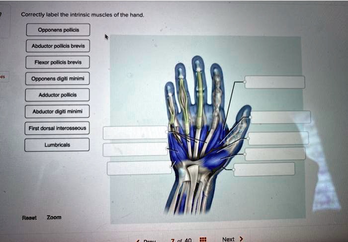 SOLVED Correctly Label The Intrinsic Muscles Of The Hand Correctly