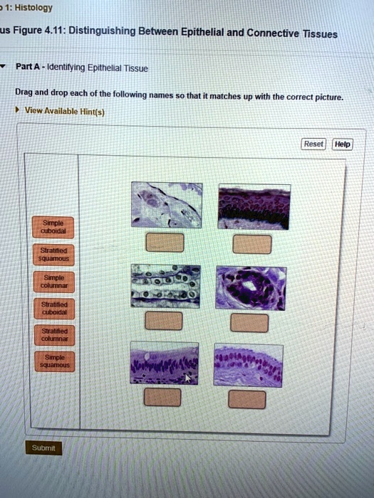 SOLVED 1 Histology Us Figure 4 11 Distinguishing Between Epithelial