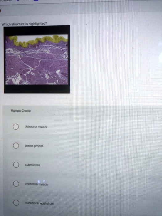 SOLVED Which Structure Is Highlighted Multiple Choice O Detrusor