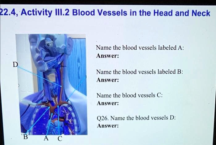 SOLVED 2 4 Activity III 2 Blood Vessels In The Head And Neck Name