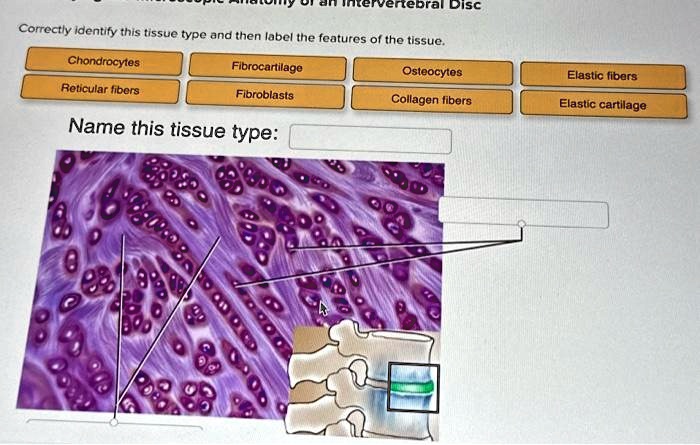 SOLVED Correctly Identify This Tissue Type And Then Label The Features