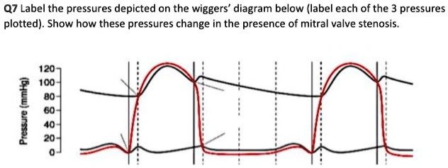 Solved Q Label The Pressures Depicted On The Wiggers Diagram Below