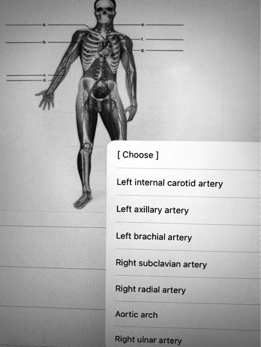 Solved Choose Left Internal Carotid Artery Left Axillary Artery Left