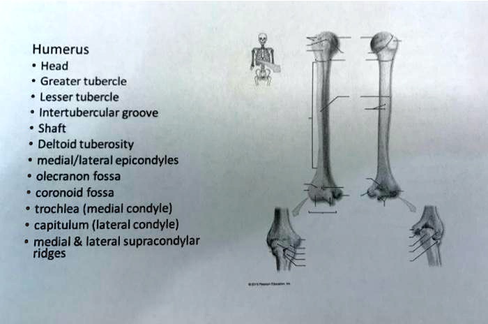 SOLVED Humerus Head Greater Tubercle Lesser Tubercle