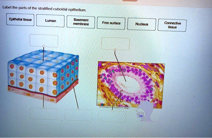 Solved Label The Parts Of The Stratified Cuboidal Epithelium