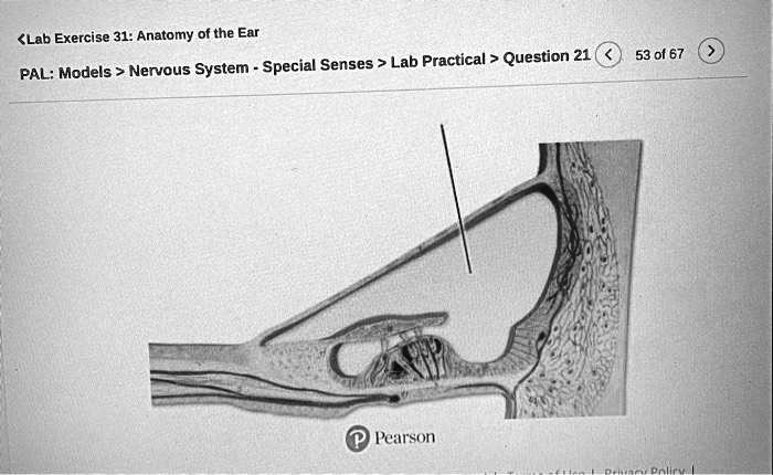 Solved Nervous System Special Senses Lab Practical Question