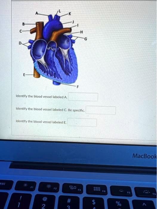 Solved Identify The Blood Vessel Labeled A Identify The Blood Vessel