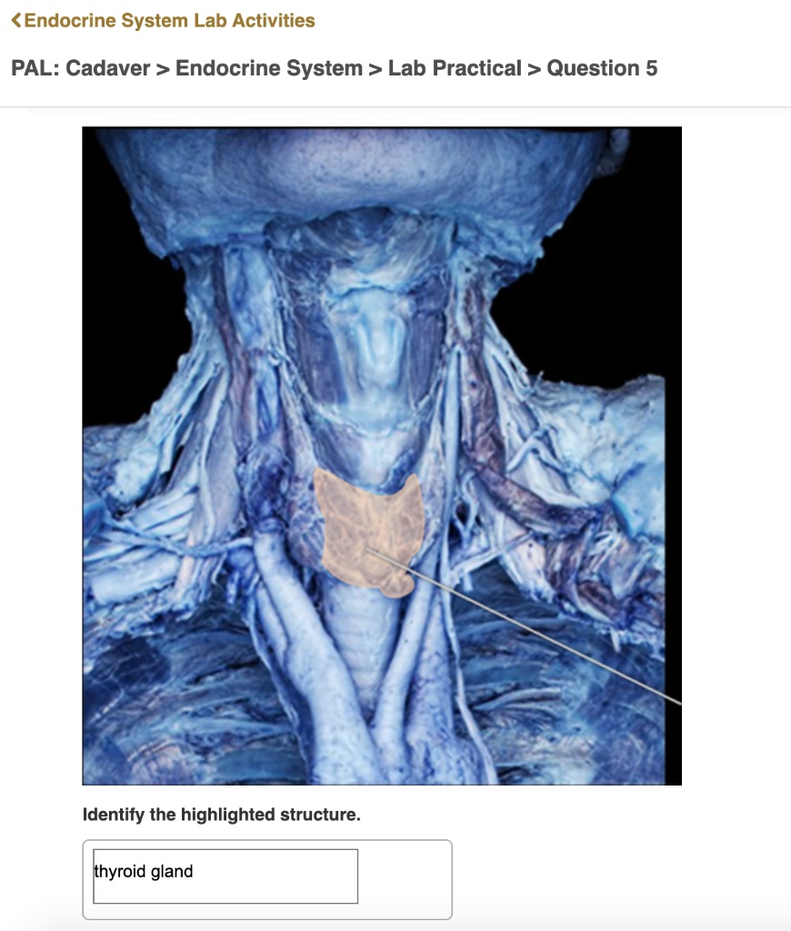 Endocrine System Lab Activities Pal Cadaver Endocrine System Lab