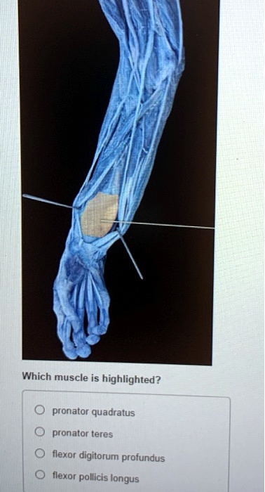 SOLVED Which Muscle Is Highlighted Pronator Quadratus Pronator Teres