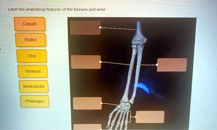 SOLVED Label The Anatomical Features Of The Forearm And Wrist Carpals