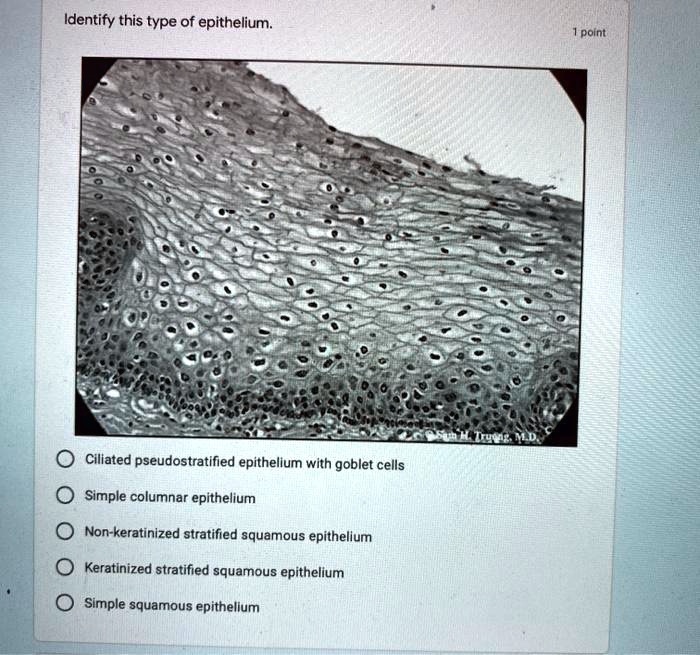 Solved Identify This Type Of Epithelium Point Ciliated