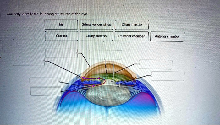 Solved Correctly Identify The Following Structures Of The Eye Iris