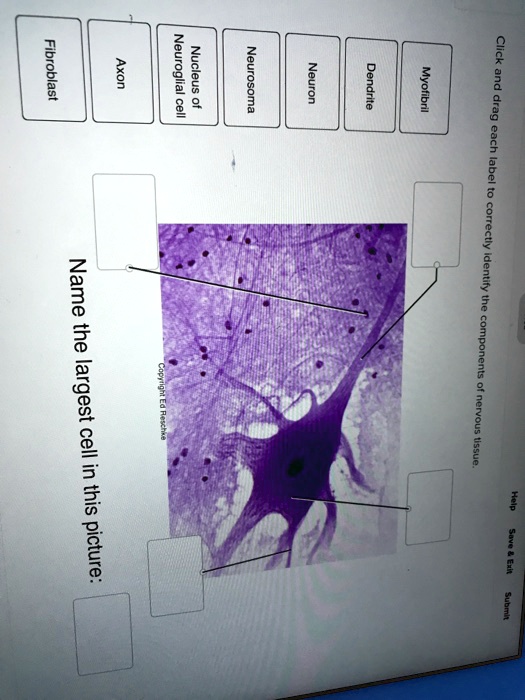 Solved Fibroblast Axon Neuroglial Cell Nucleus Of Neurosoma Neuron