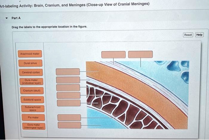 Solved Text Art Labeling Activity Brain Cranium And Meninges Close Up View Of Cranial