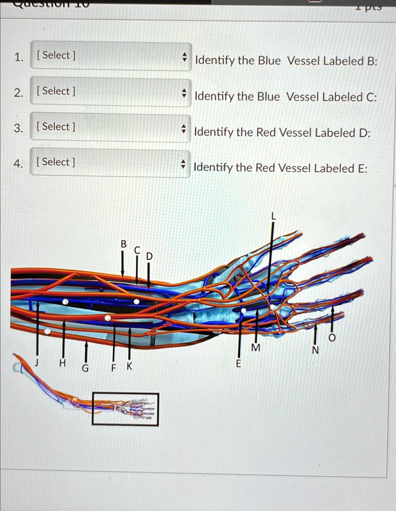 Solved Identify The Blue Vessel Labeled B Identify The Blue Vessel