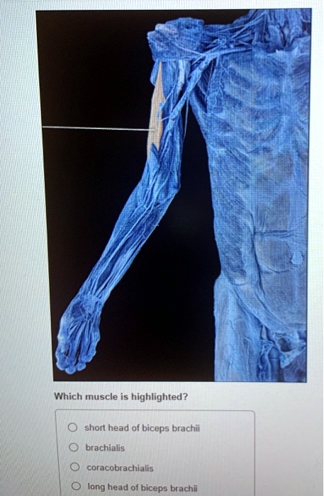 SOLVED Which Muscle Is Highlighted Short Head Of Biceps Brachii