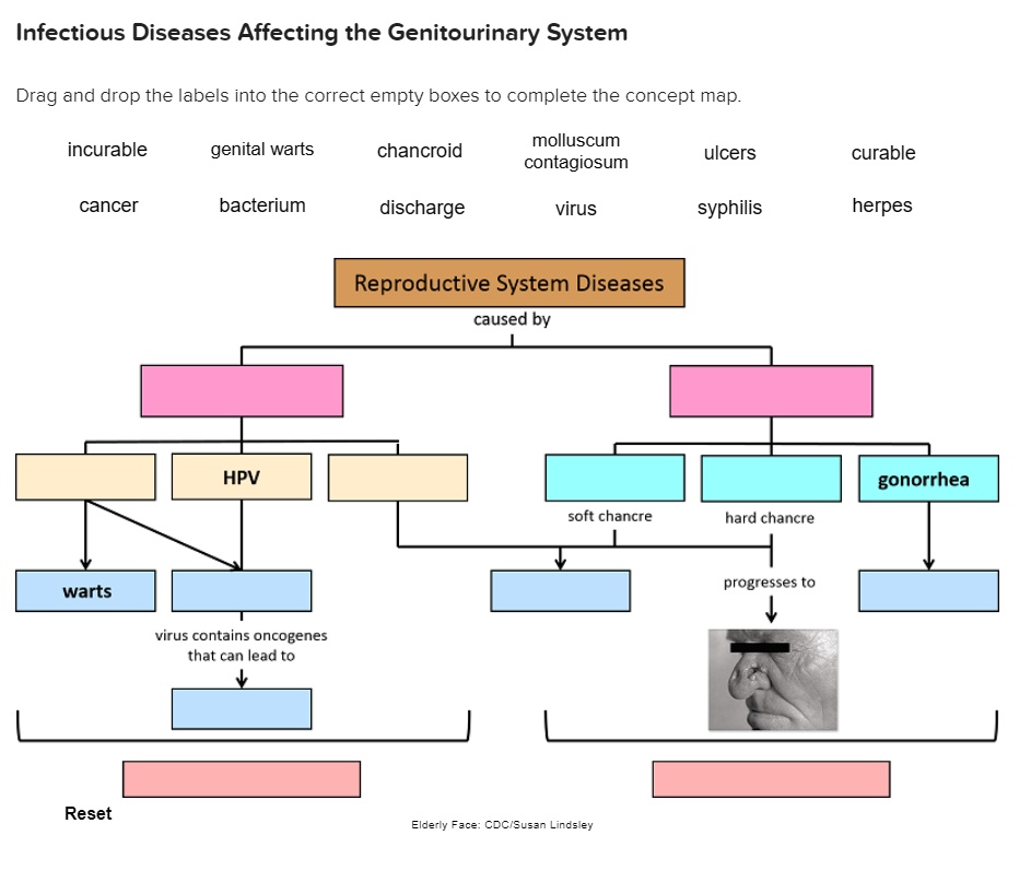 Infectious Diseases Affecting The Genitourinary System Drag And Drop