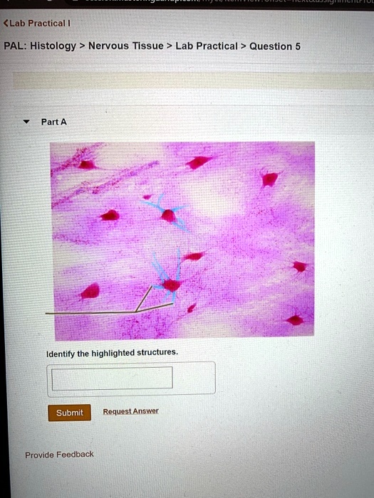 Solved Lab Practical Histology Nervous Tissue Lab Practical