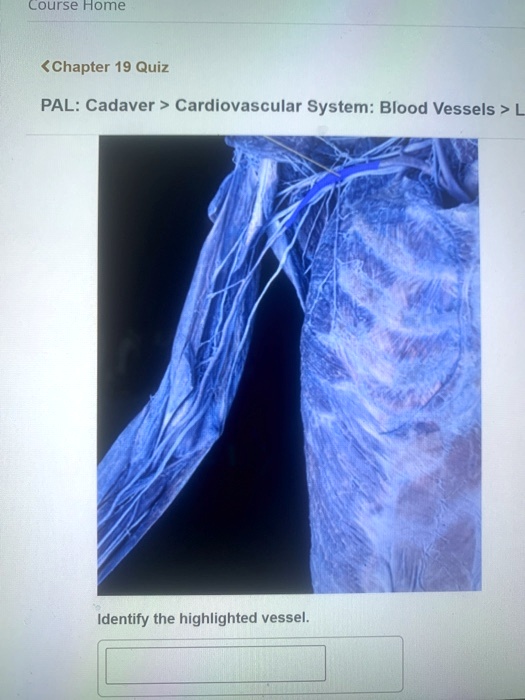 SOLVED Course Home Chapter 19 Quiz PAL Cadaver Cardiovascular