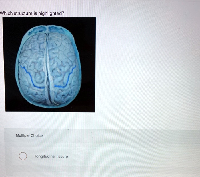 SOLVED Which Structure Is Highlighted Multiple Choice Longitudinal