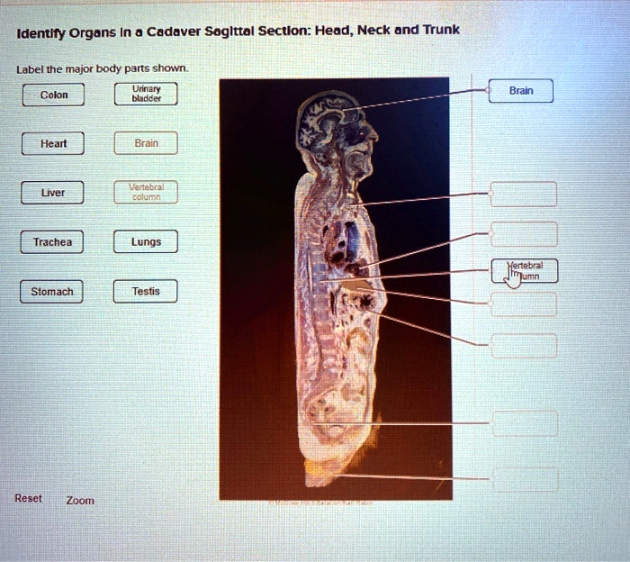 SOLVED Identify Organs In A Cadaver Soglttol SectionHead Neck And