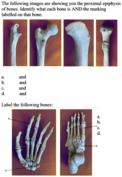 SOLVED The Following Images Are Showing You The Proximal Epiphysis Of