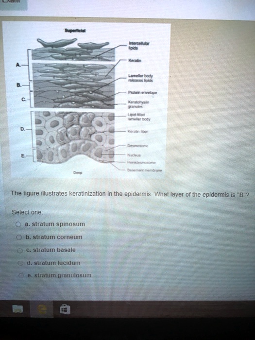 Solved The Figure Illustrates Keratinization In The Epidermis What