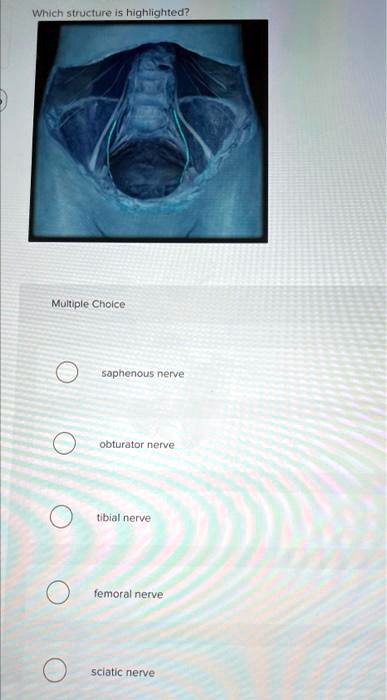 Video Solution Which Structure Is Highlighted Multiple Choice