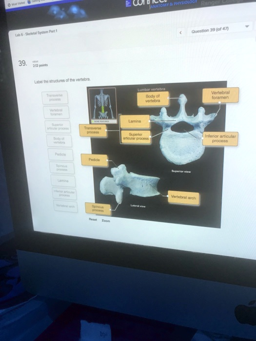 Solved Lab Skeletal System Part Question Of Points