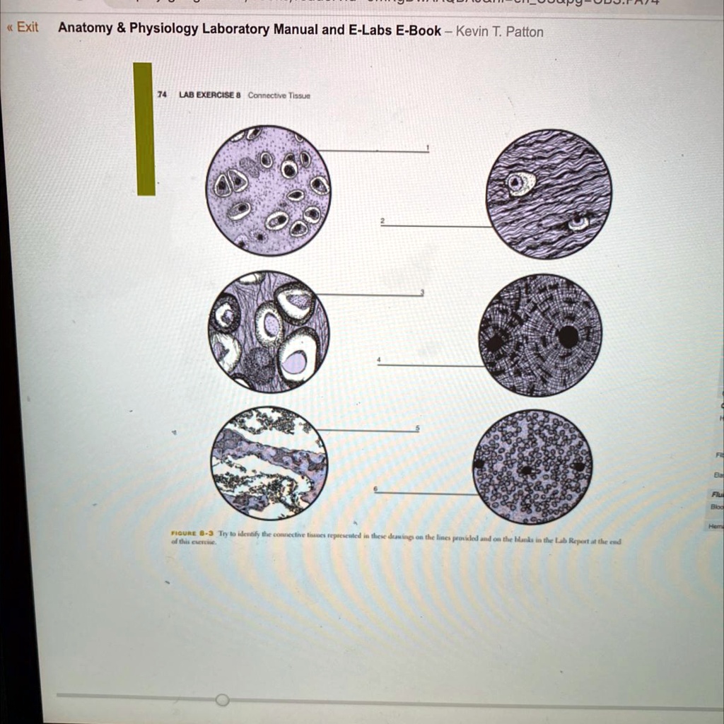 SOLVED Examples Of Majo TISSUE Fibrous Loose Ordinary Careciart