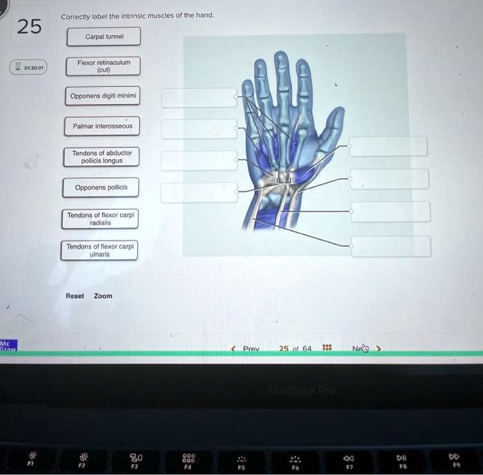 Solved Correctly Label The Intrinsic Muscles Of The Hand Carpal