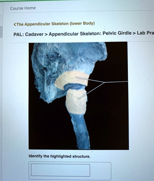 Solved Course Home The Appendicular Skeleton Lower Body Pal Cadaver