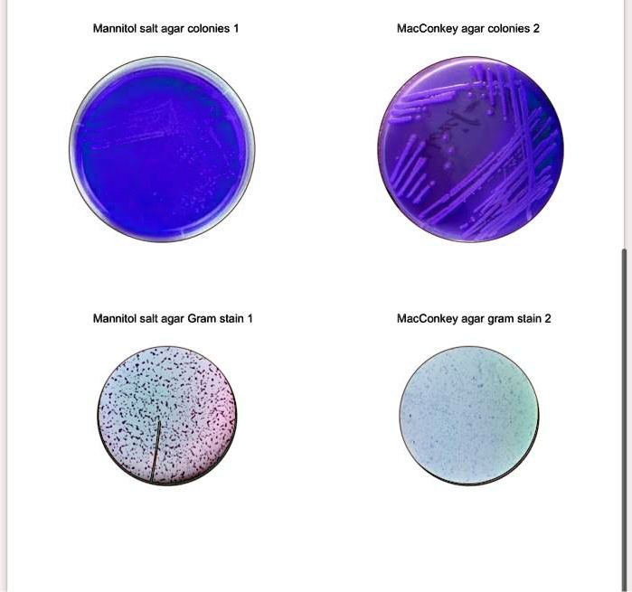 Solved Genus And Species For Unknown Gram Mannitol Salt Agar