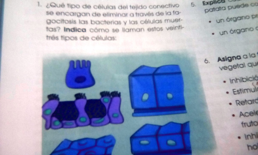 SOLVED Xfa ayudenme 1que tipo de células del tejido