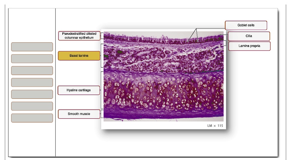 Solved Goblet Cells Pseudostratified Ciliated Columnar Epithelium