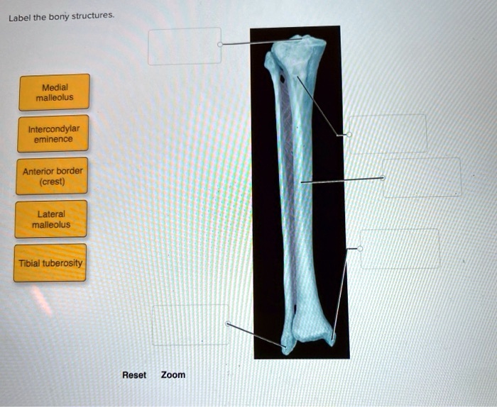 SOLVED Label The Bony Structures Medial Malleolus Intercondylar