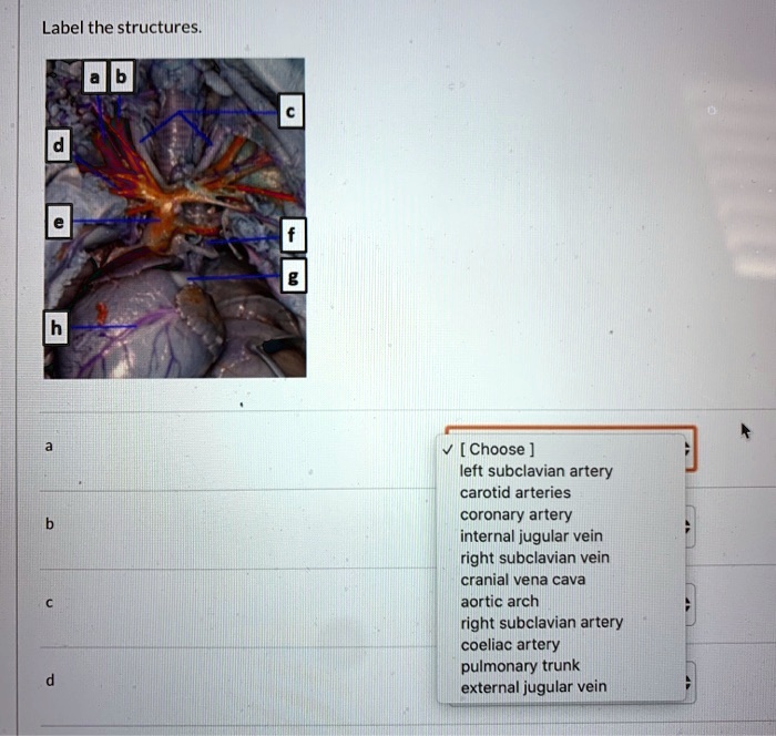 SOLVED Label The Structures Choose Left Subclavian Artery Carotid