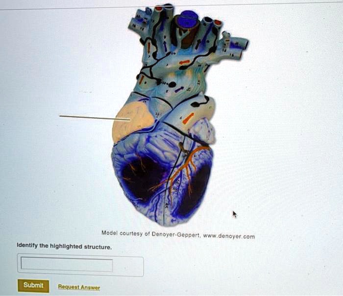 Solved Model Courtesy Of Denoyer Geppert Denoyer Identify The