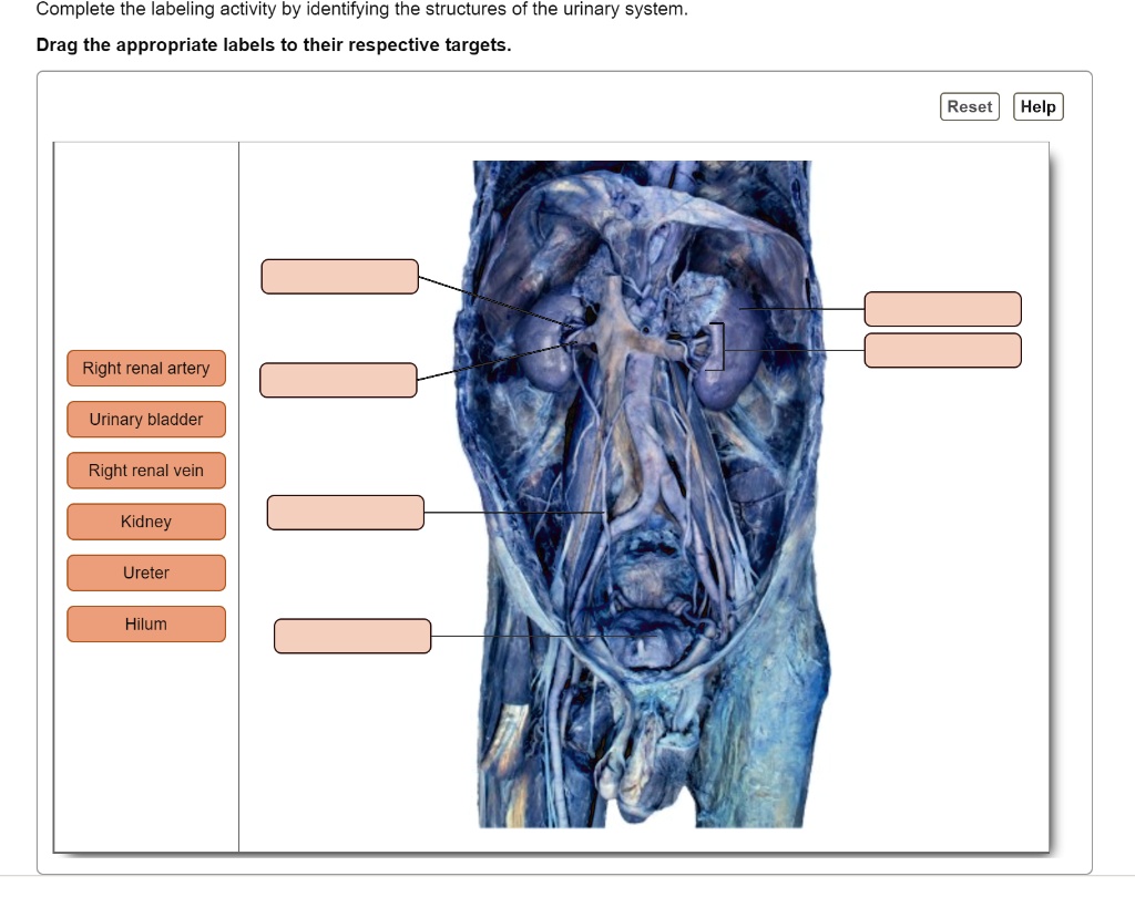 Solved Complete The Labeling Activity By Identifying The Structures Of