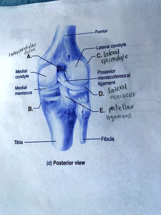 Solved Femur Lateral Condyle Medial Condyle Medial Meniscus Posterior