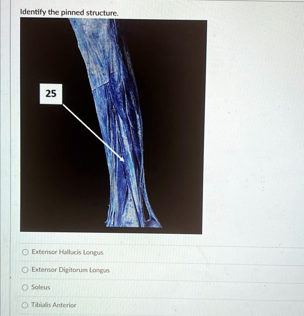 SOLVED Identify The Pinned Structure Extensor Hallucis Longus