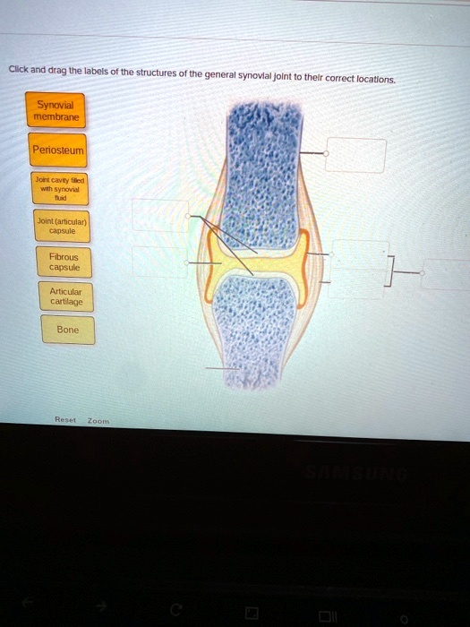 Solved Click And Drag The Labels Of The Structures Of The General