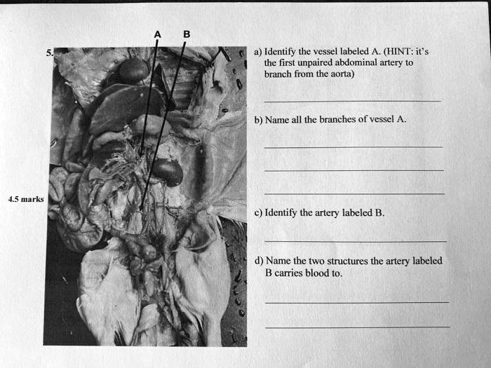 Solved Identify The Vessel Labeled A Hint It The First Unpaired